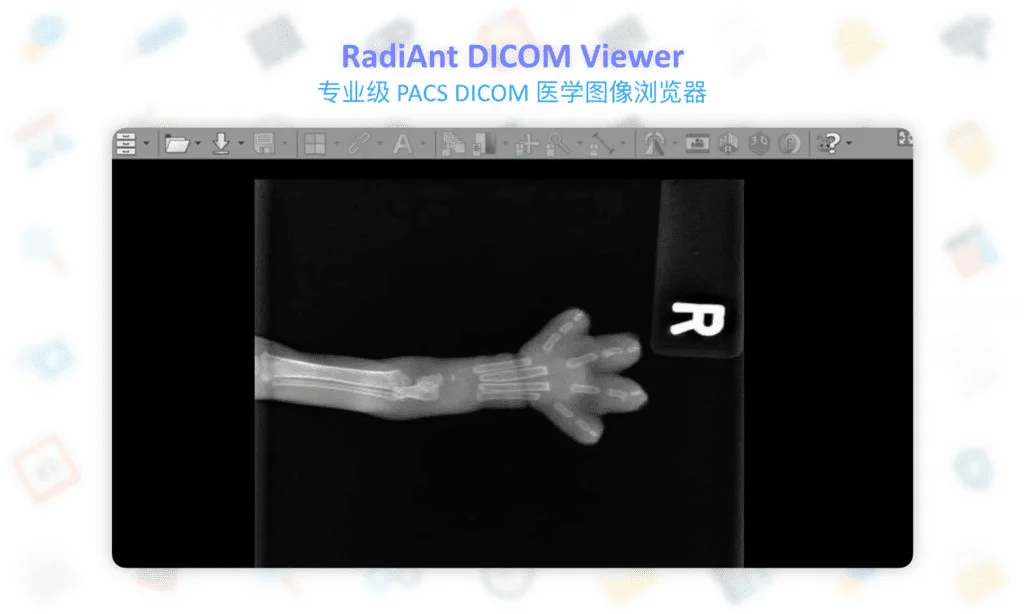 RadiAnt DICOM Viewer